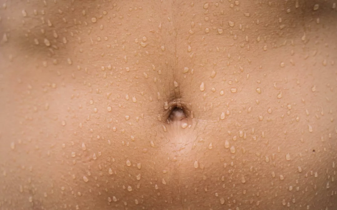 Syndrome de l’intestin irritable