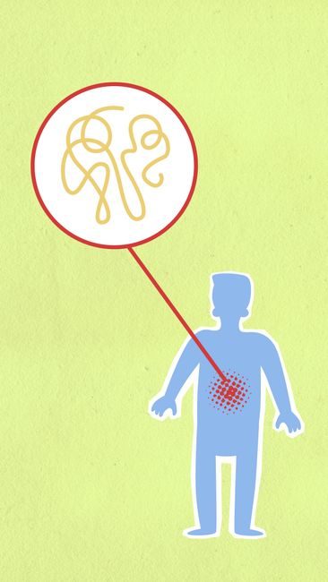Qu’est-ce que la perméabilité intestinale ? Qu'est-ce que la perméabilité intestinale ? – consultation nutritionniste